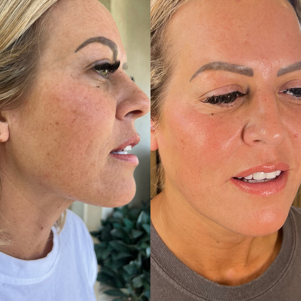 Dehydration & dullness — before and after at The Face Tonic