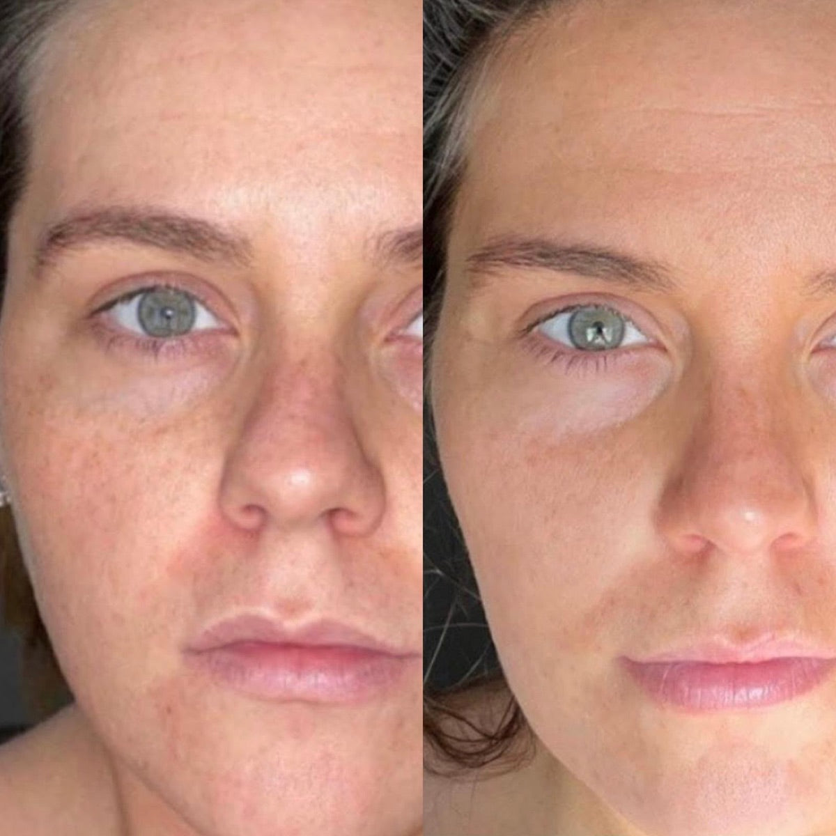 Lines & texture — before and after at The Face Tonic