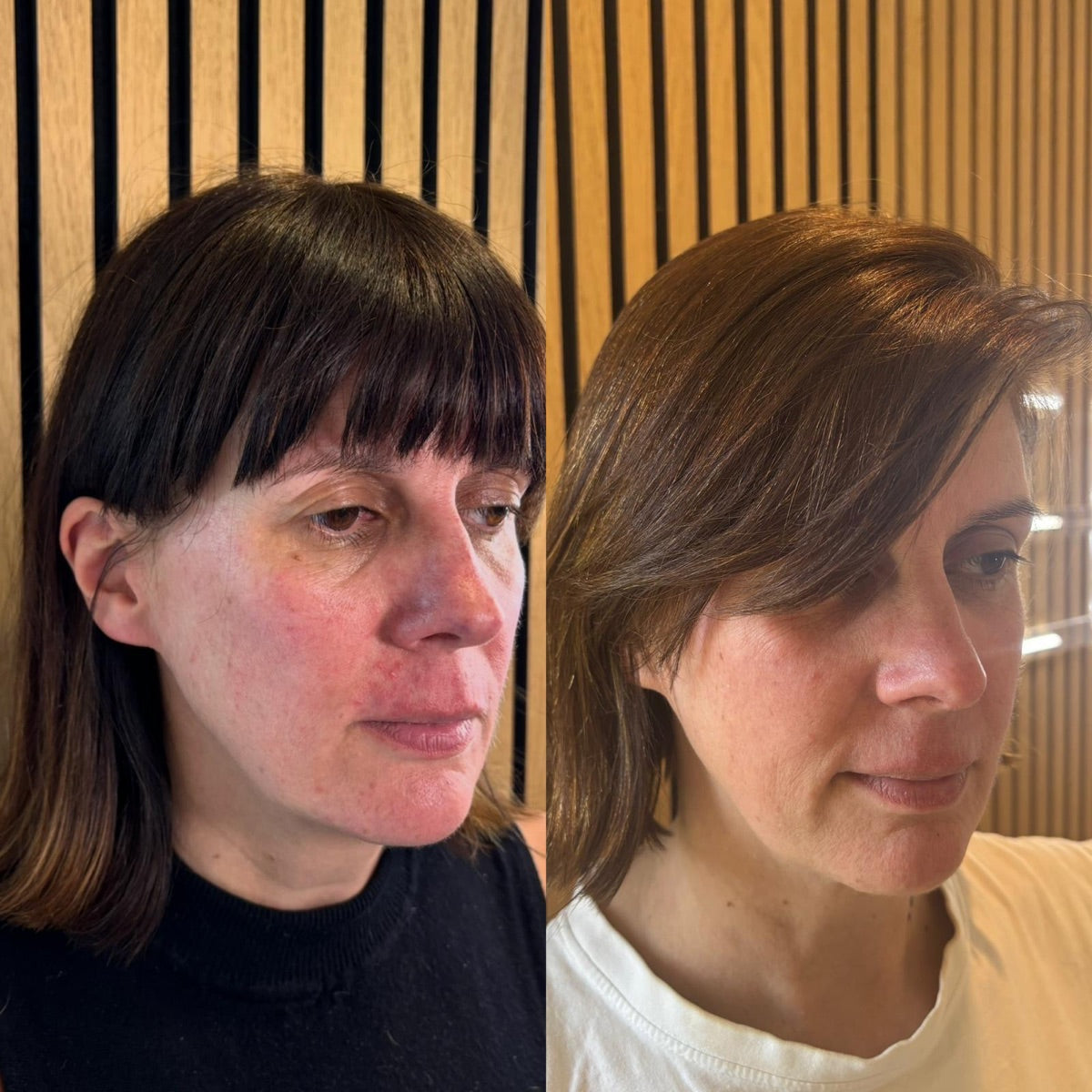 Rosacea & redness — before and after at The Face Tonic